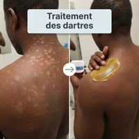 X-CONFORT - CRÈME TRAITEMENT POUR LA PEAU