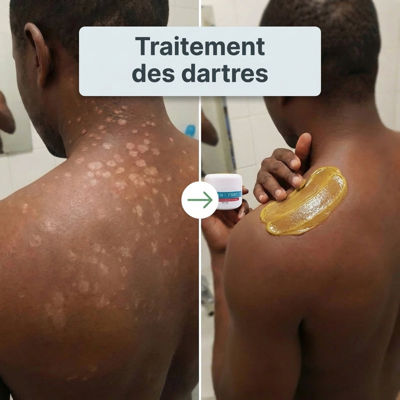 Avant apres 5