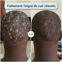 X-CONFORT - CRÈME TRAITEMENT POUR LA PEAU