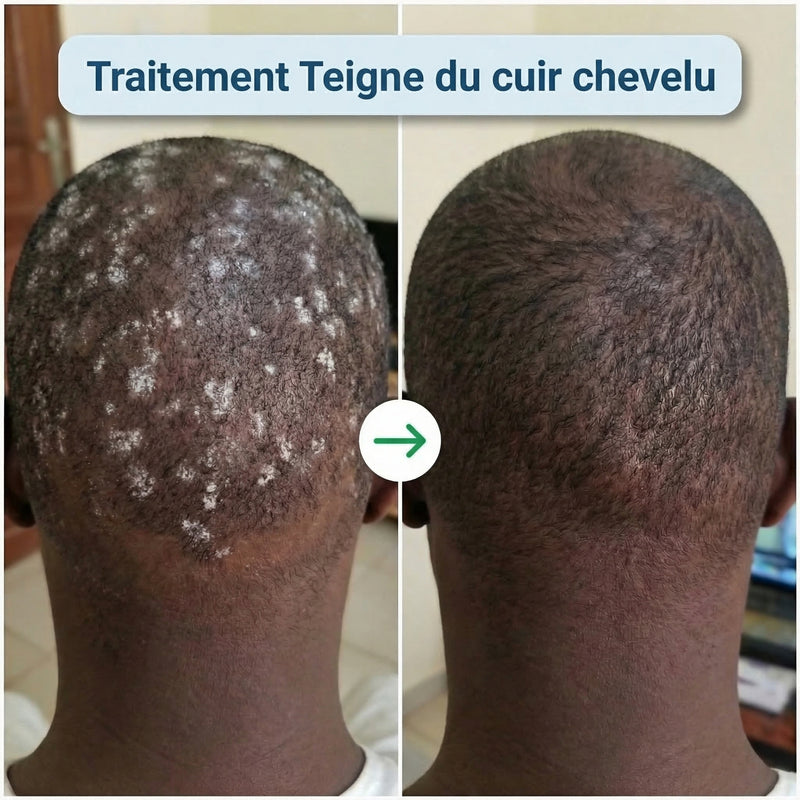 Avant apres 6