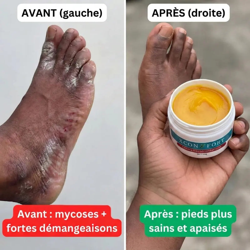 Avant apres 4
