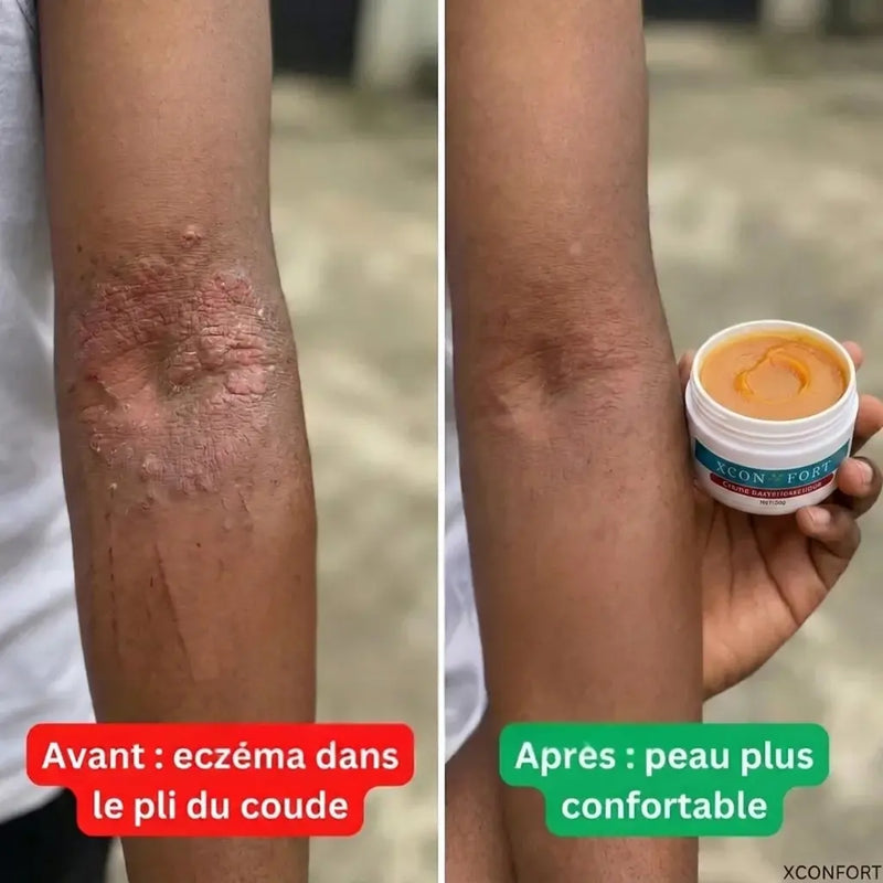 Avant apres 9
