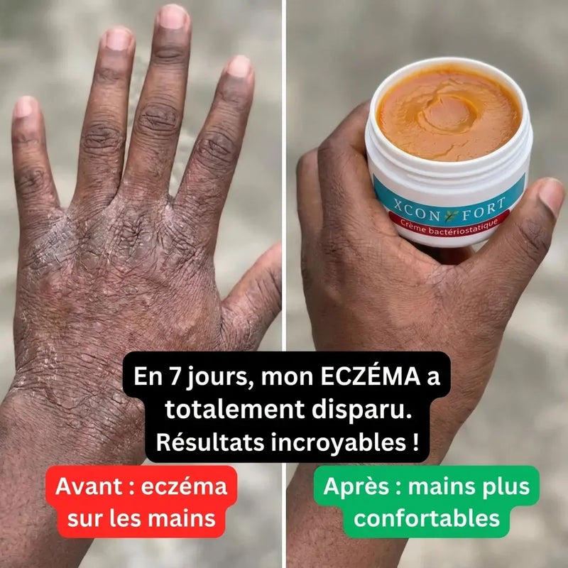 Avant apres 1